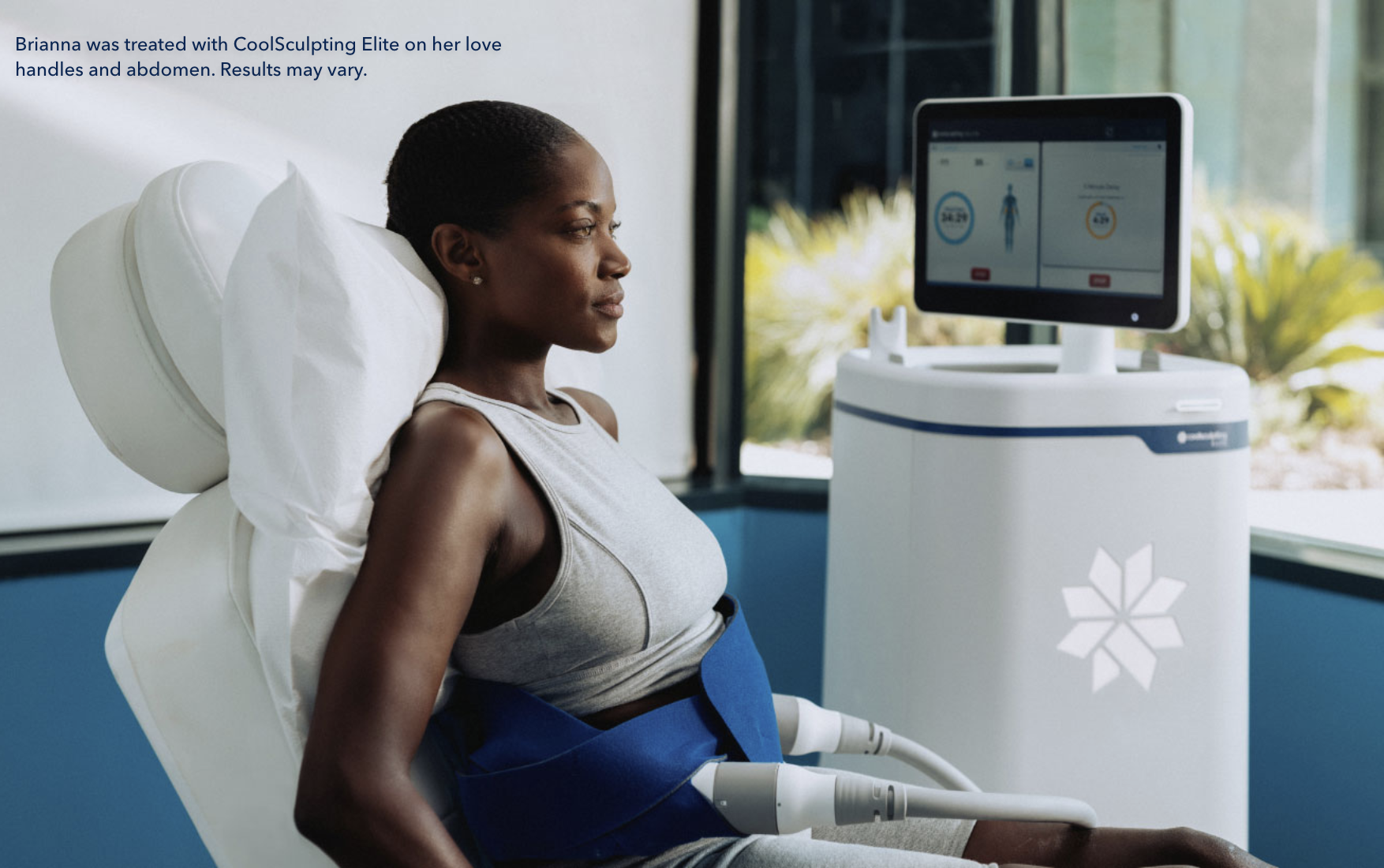 female patient receiving CoolSculpting Elite treatments