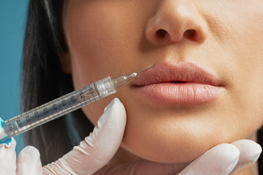 Longest-Lasting Lip Filler in Bel Air, Maryland: Which Dermal Fillers Provide the Most Durable Results?