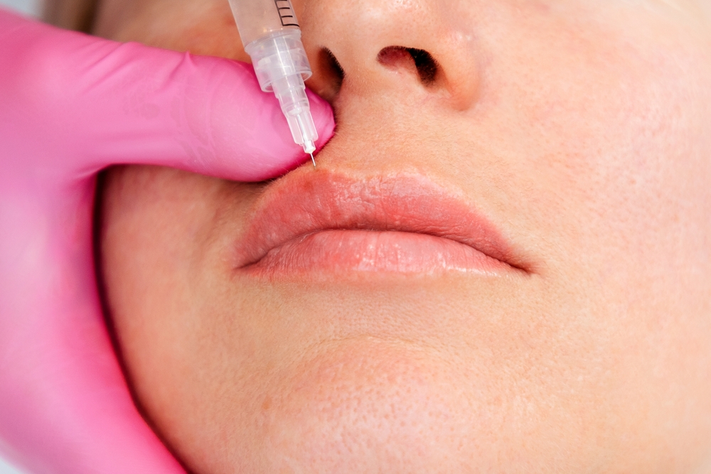 Mini Lip Filler Prices in Timonium, Maryland: Affordable Options for Subtle Lip Enhancement