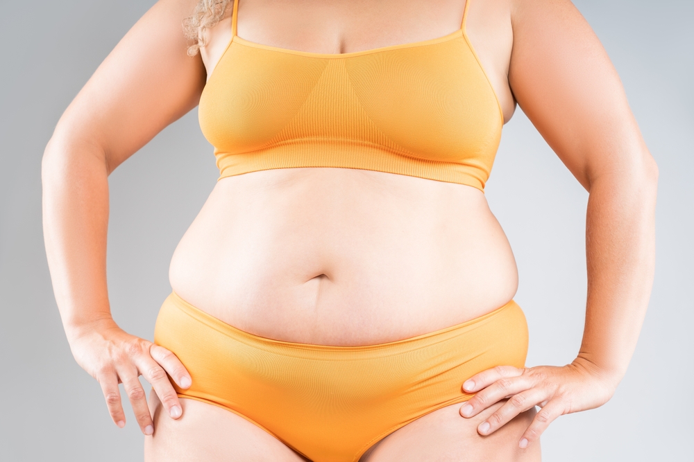 Tummy Tuck